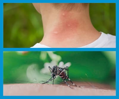 A quoi servent les moustiques : la véritable utilité des